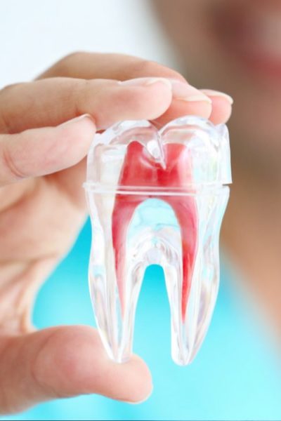 Root Canals and You: Top 10 Questions Answered