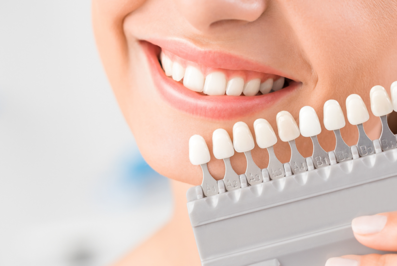 Differenttypesofdentalimplants1080x675 Beauty Army understanding the different types of dental implants