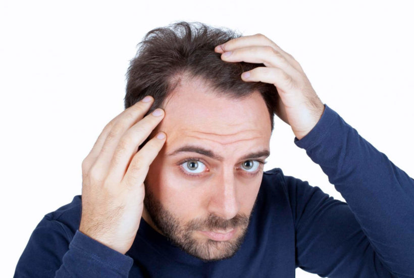 the 5 hair loss treatments for men