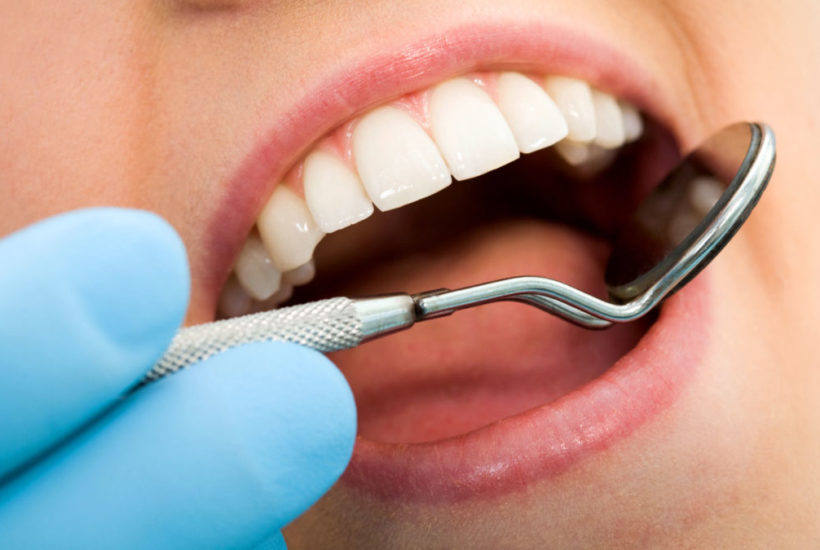 5 Worst Things For Your Teeth