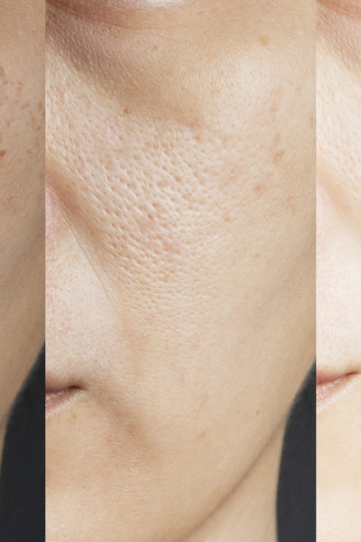 an everything guide to avoid dull skin