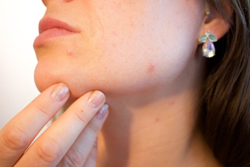 Skin Treatment Services in About Face – Brisbane